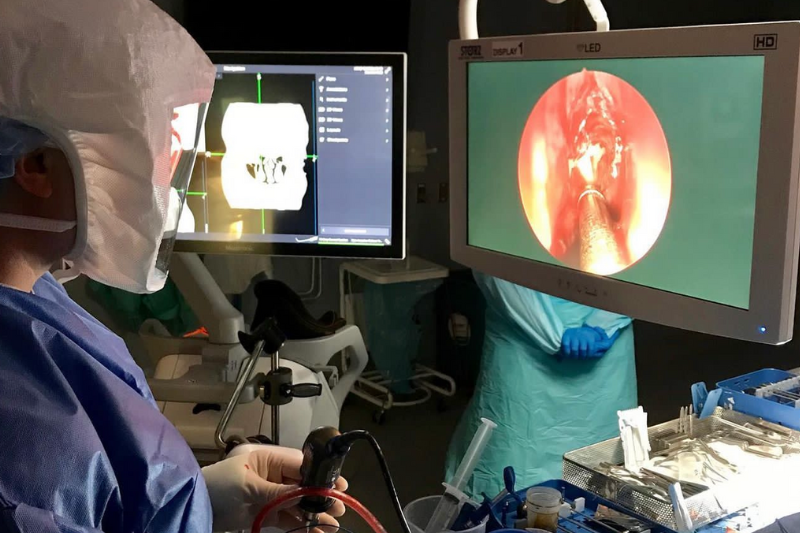 endoscopic sinus surgery